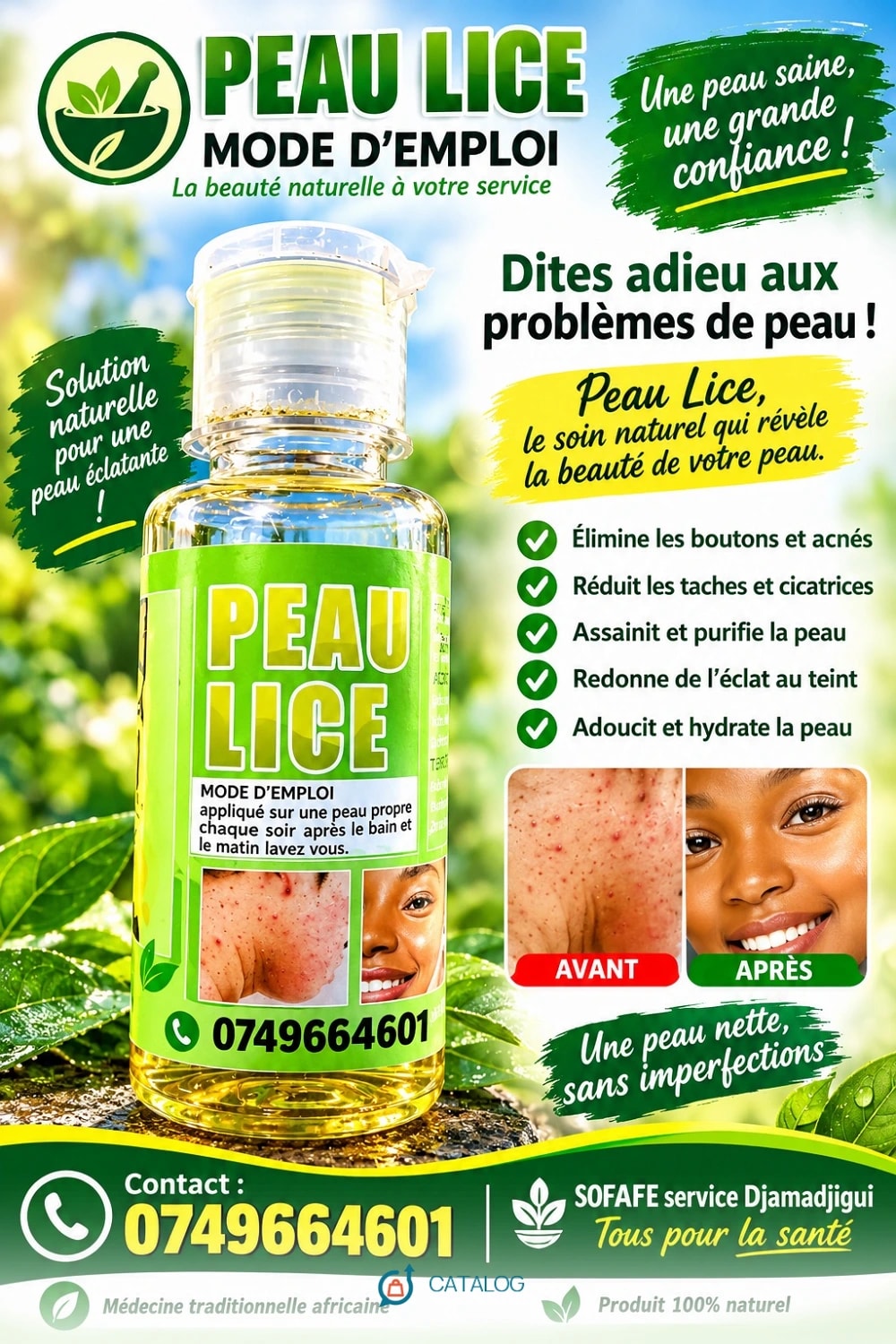 Huile Peau Lice